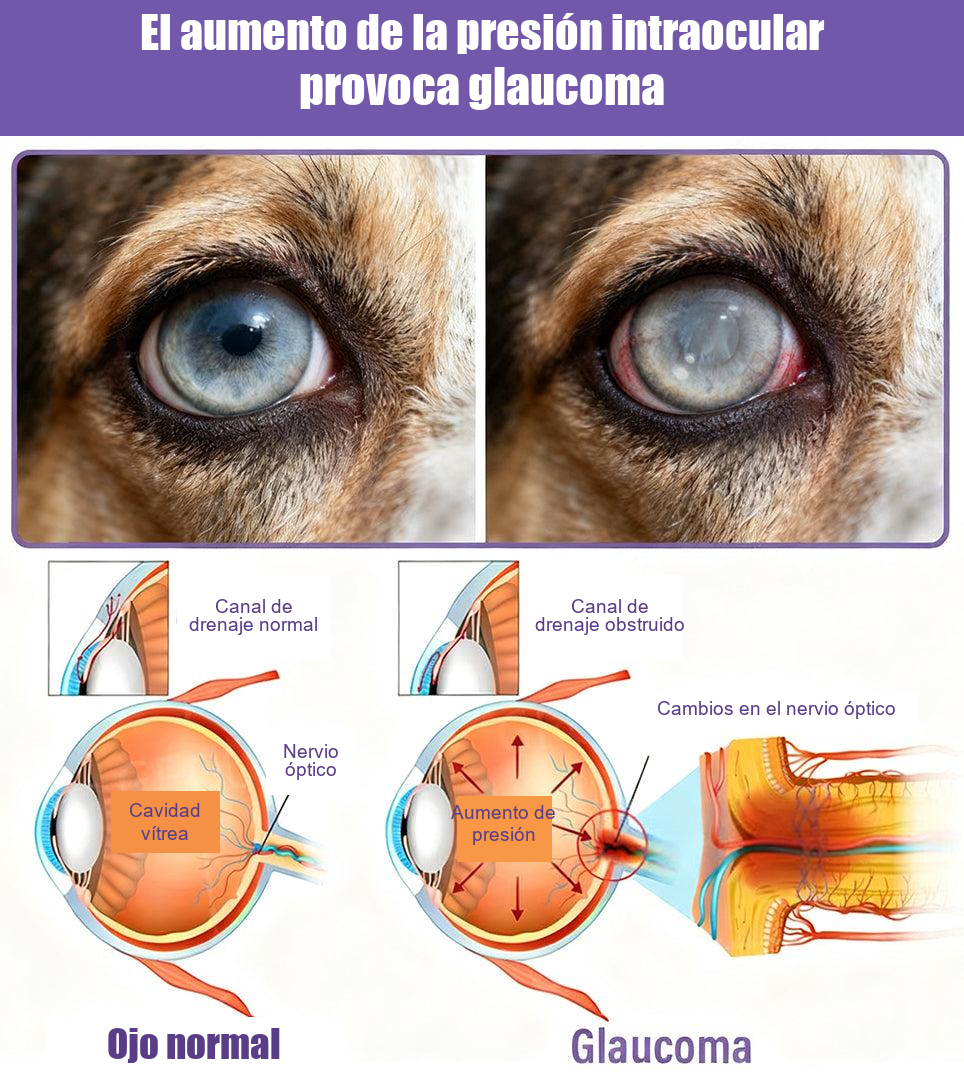ojo con glaucoma